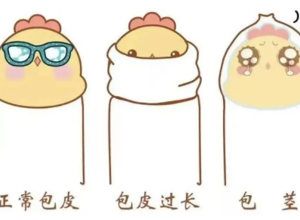 【丁丁历险记】家长必看！暑期到来，要不要带孩子割包皮？