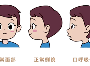 孩子睡觉张嘴、打呼噜？家长当心！别让“口呼吸”偷走孩子的颜值和健康