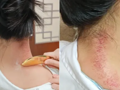 下班后也能做推拿和理疗！香洲区中西医结合医院周三、周五夜间门诊暖心来袭