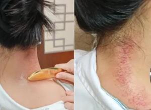 下班后也能做推拿和理疗！香洲区中西医结合医院周三、周五夜间门诊暖心来袭