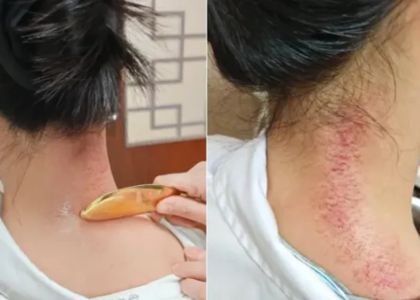 下班后也能做推拿和理疗！香洲区中西医结合医院周三、周五夜间门诊暖心来袭